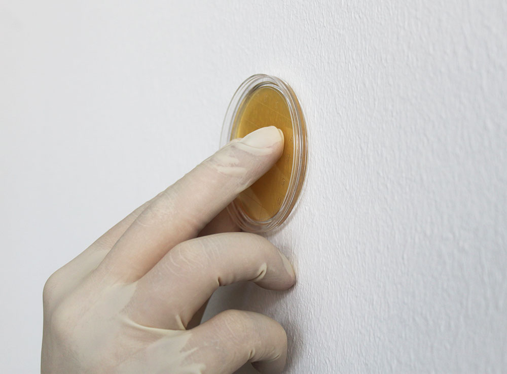 Analisi muffe campione superfice